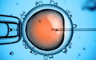 Technologies de procréation assistée